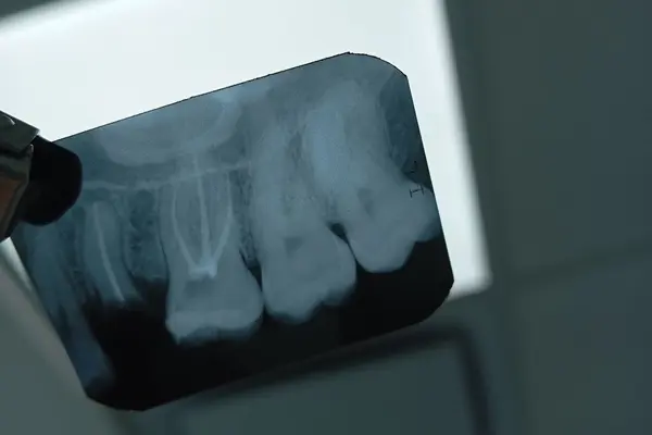 endodoncia120